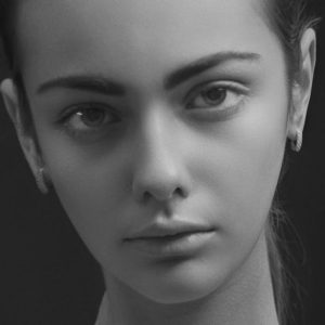 Cuándo se ven los resultados finales de la bichectomía