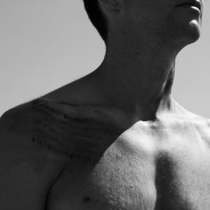 Ginecomastia vs pseudoginecomastia diferencias clave