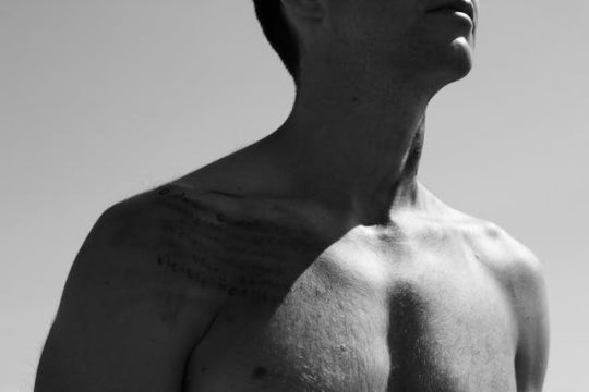 Ginecomastia vs pseudoginecomastia diferencias clave