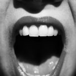 Beneficios de la fisioterapia en trastornos de la articulación temporomandibular