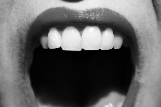 Beneficios de la fisioterapia en trastornos de la articulación temporomandibular